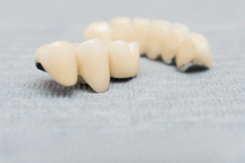 Dental bridge on a textured surface.
